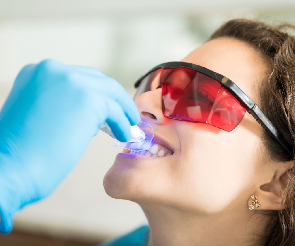 Blanqueamiento Dental